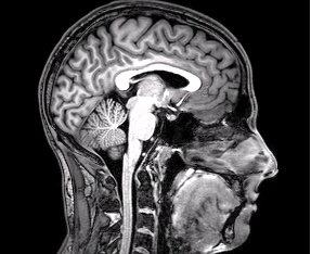 fMRI'da metaforik bir cümle duyulduğunda dokunma korteksi ışıldıyor; beyin gerçekten 'dokunuyor'.